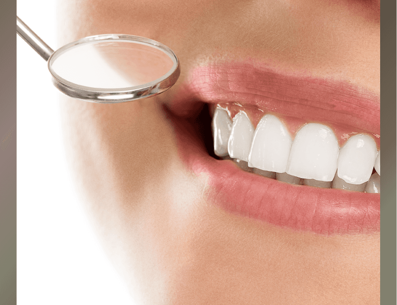 專業牙科美容與保健服務:即日全瓷牙貼、隱形牙箍、藍光漂牙及專業洗牙